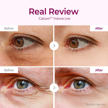 Volumizing Calcium Under Eye Patches 60 Count
