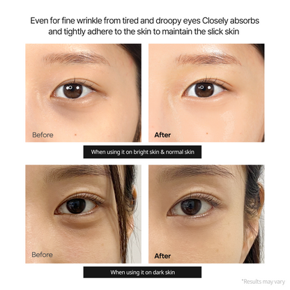 Calcium Dark Spot Eye Cream Brightening Treatment