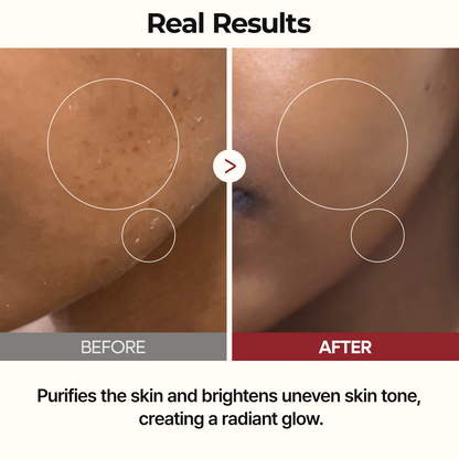 Rice Glow Toner Exfoliating Skin Brightening Treatment