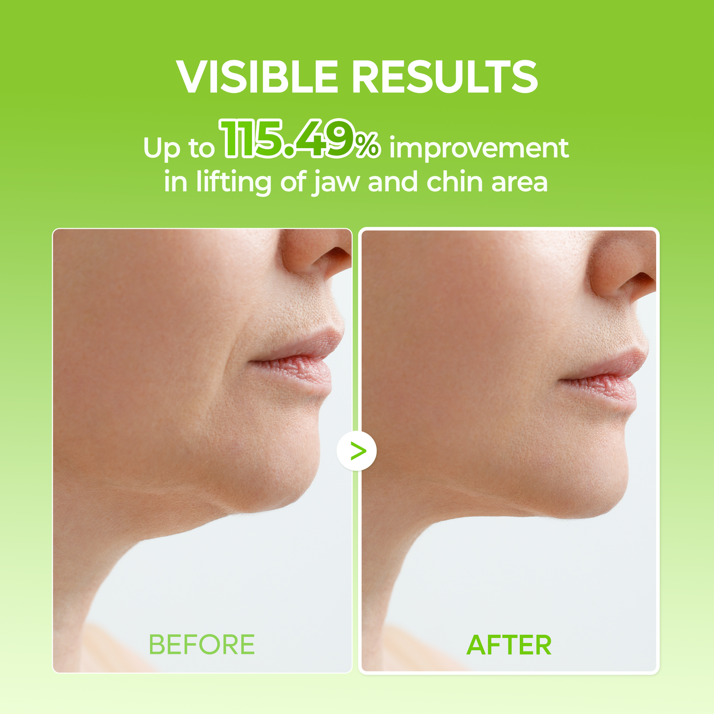 V Lifting Face Slimming Band Chin Strap 4 Pack