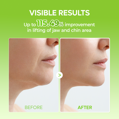 V Lifting Face Slimming Band Chin Strap 4 Pack