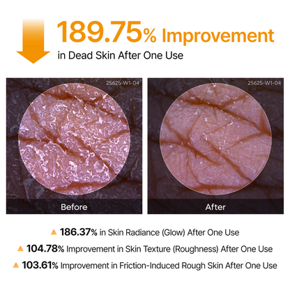 Kojic Acid Turmeric Brightening Peel Spray
